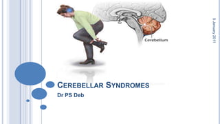 Cerebellar Syndromes Dr PS Deb 28 October 2010 