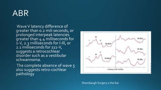 Shambaugh Surgery o the Ear
 