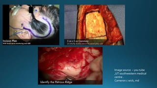 Image source – you tube
,UT southwestern medical
centre .
Cameron c wick, md
 