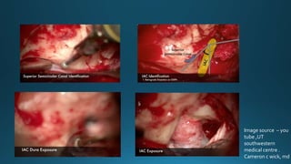 Image source – you
tube ,UT
southwestern
medical centre .
Cameron c wick, md
 