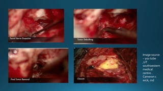 Image source
– you tube
,UT
southwestern
medical
centre .
Cameron c
wick, md
 