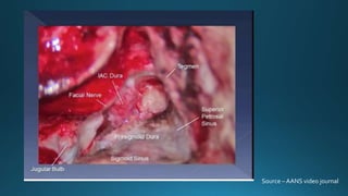 Source – AANS video journal
 