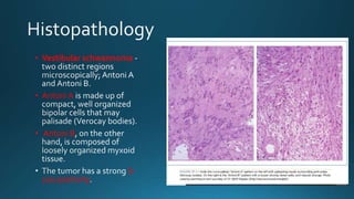 • Vestibular schwannoma
• Antoni A
• Antoni B
S-
100 positivity
 