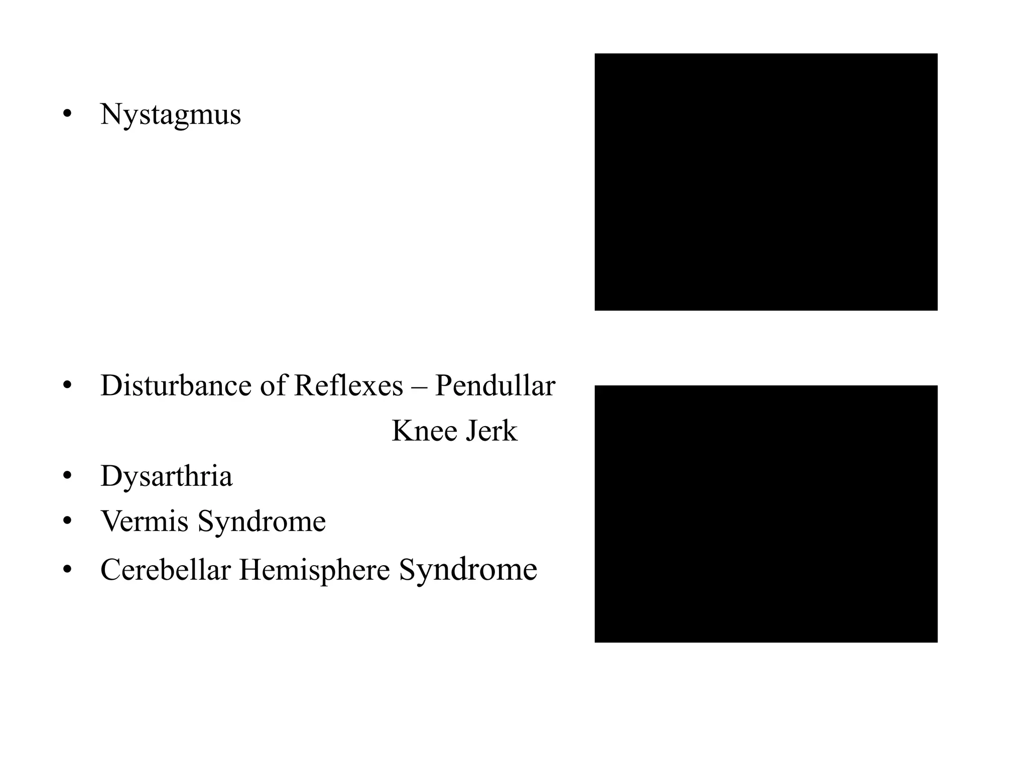 • Nystagmus
• Disturbance of Reflexes – Pendullar
Knee Jerk
• Dysarthria
• Vermis Syndrome
• Cerebellar Hemisphere Syndrome
 