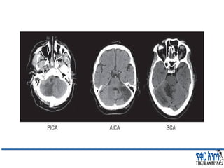 Comprehensive Overview of Cerebellum: Anatomy, Functions, and Disorders ...