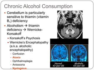 Cerebellum And Alcohol | PPTX