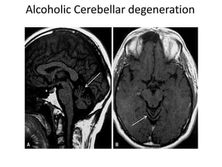 Cerebellum and its connections | PPTX
