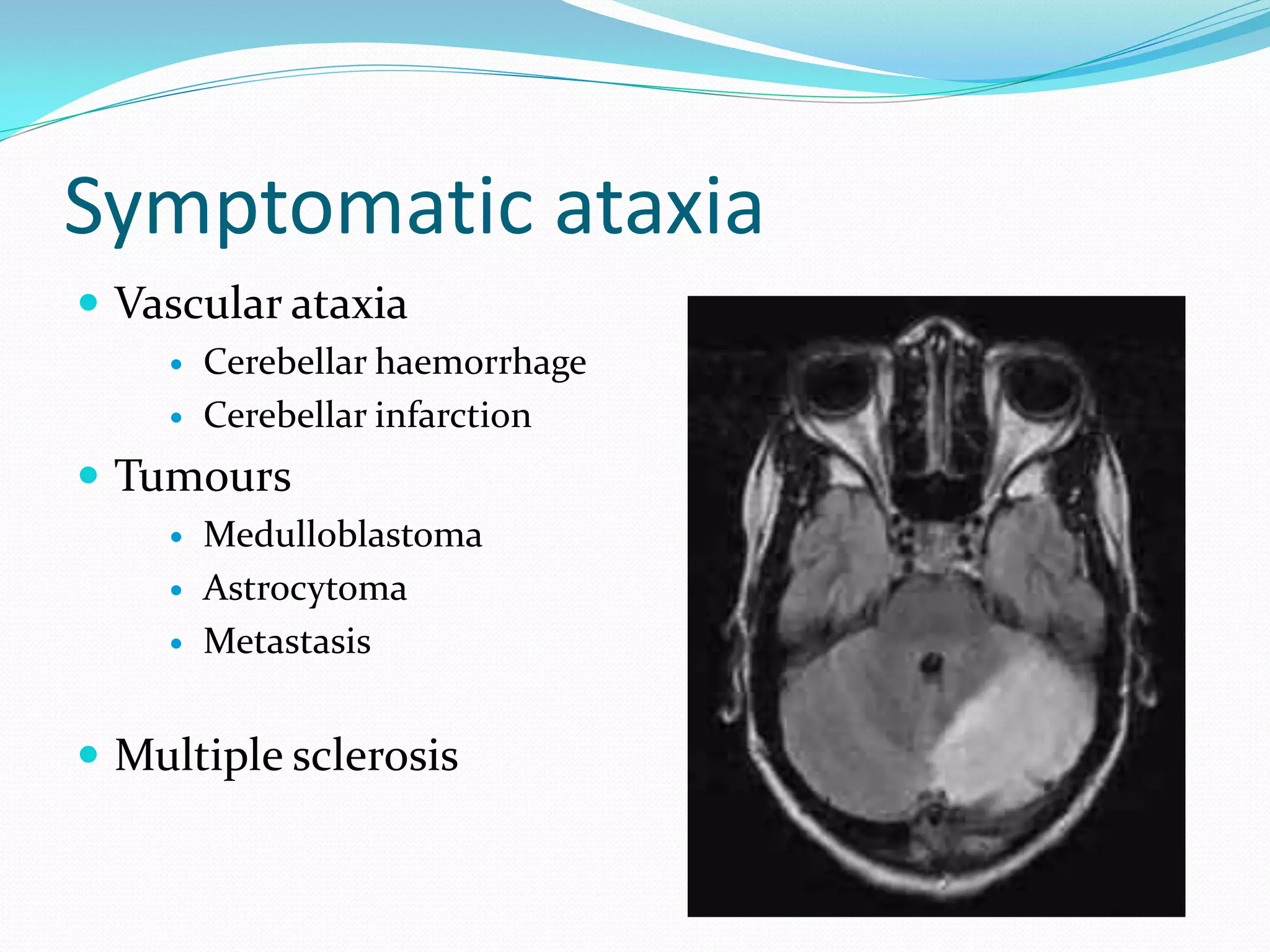 Cerebellum & ataxia | PDF