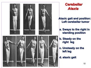Cerebellum by suresh aadi8888 | PPT