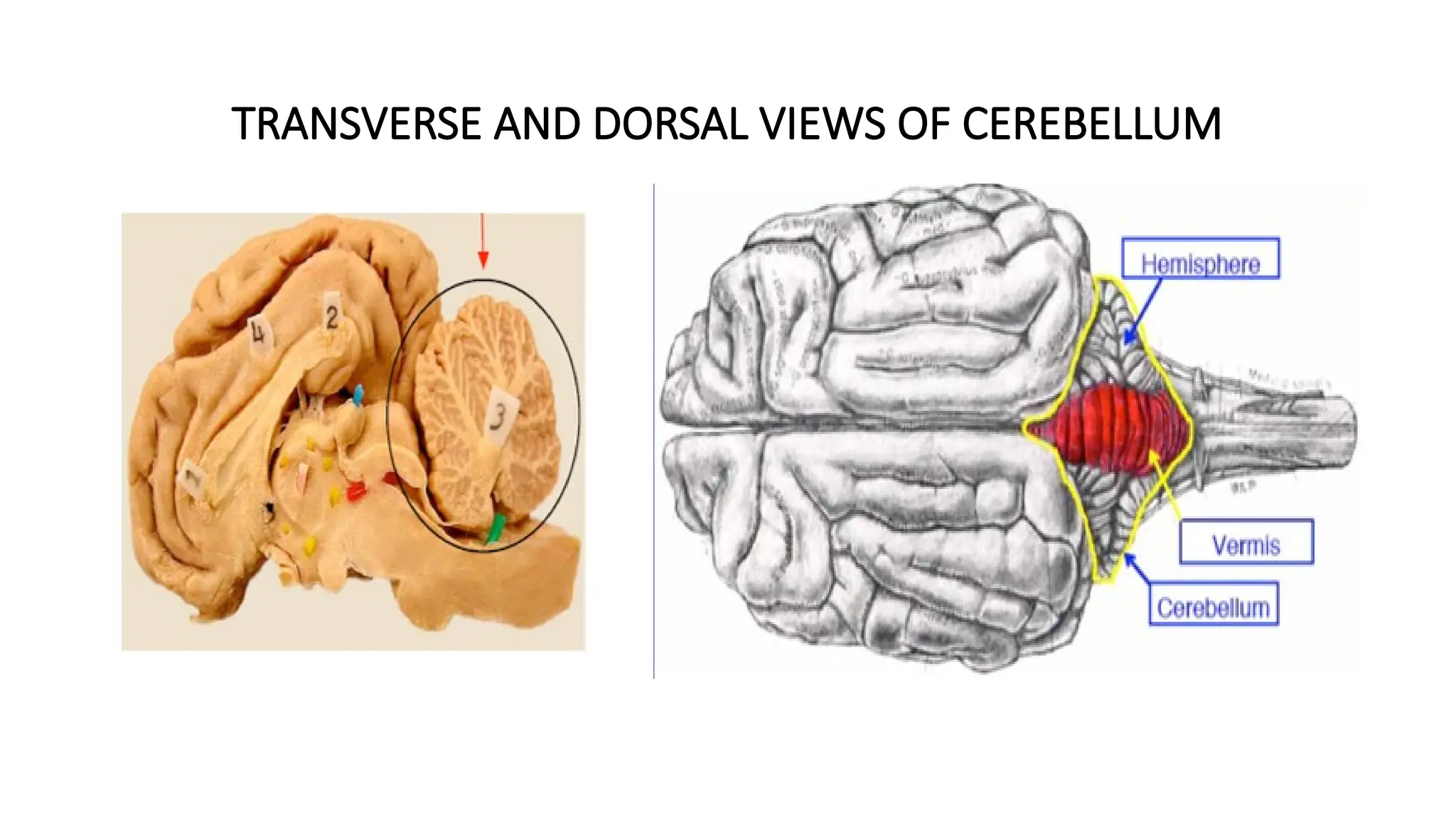 TRANSVERSE AND DORSAL VIEWS OF CEREBELLUM
 