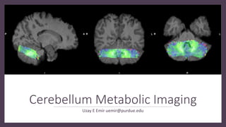 Cerebellum Metabolic Imaging
Uzay E Emir uemir@purdue.edu
 