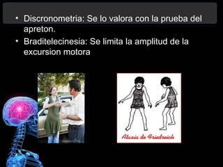 • Discronometria: Se lo valora con la prueba del
  apreton.
• Braditelecinesia: Se limita la amplitud de la
  excursion motora.
 