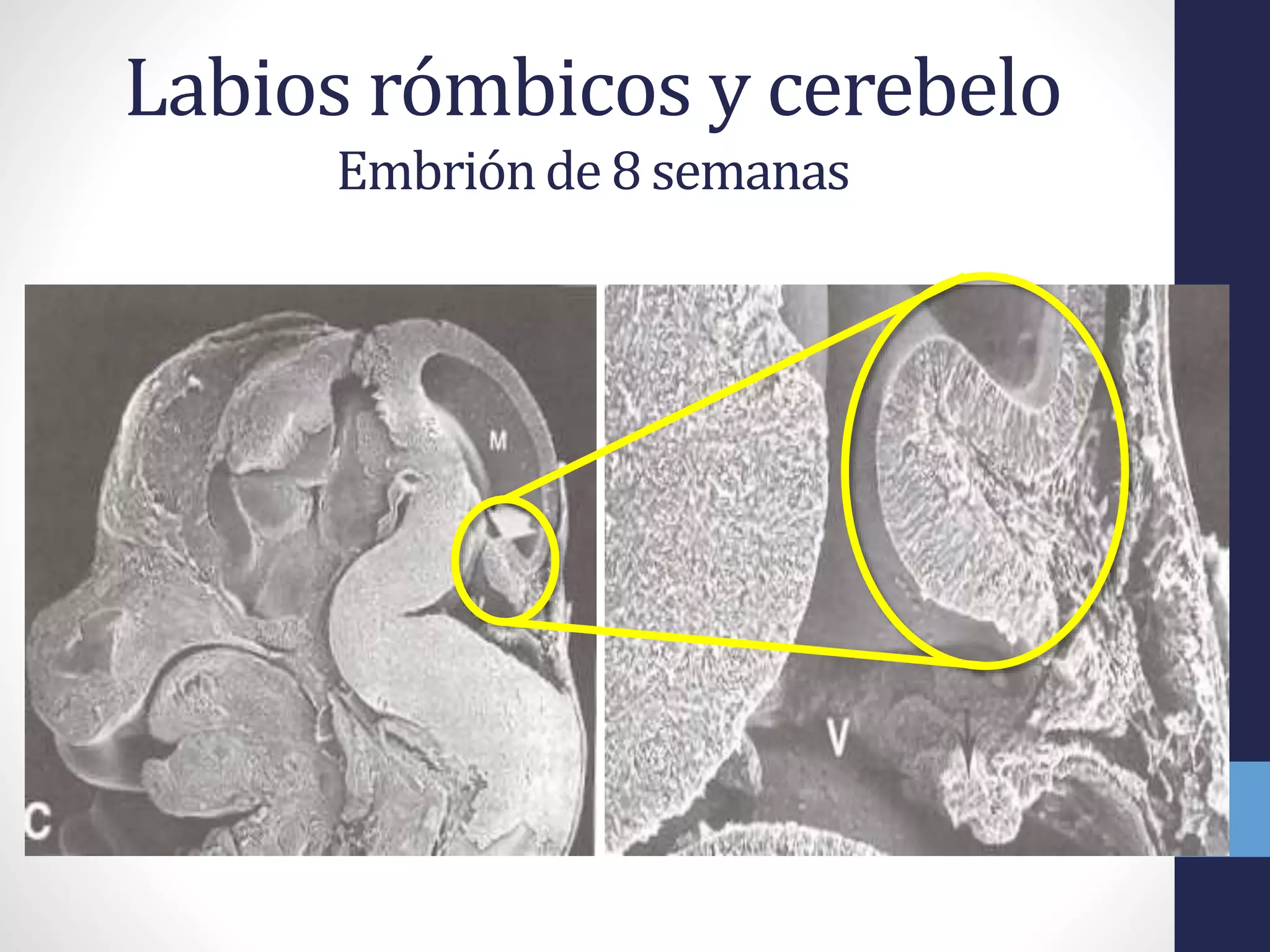 Labios Rombicos Cerebelo | PPTX | Brain and Nervous System Disorders | Diseases and ...