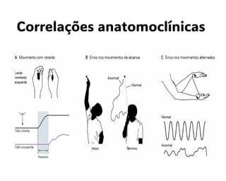 Correlações anatomoclínicas
 