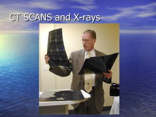 CT SCANS and X-rays 