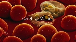 Cerebral Malaria
 