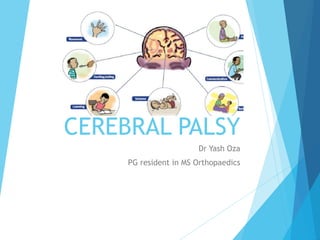 CEREBRAL PALSY
Dr Yash Oza
PG resident in MS Orthopaedics
 