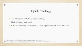 Cerebral Amyloid Angiopathy | PPT