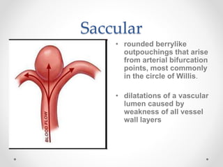 Saccular
• rounded berrylike
outpouchings that arise
from arterial bifurcation
points, most commonly
in the circle of Willis.
• dilatations of a vascular
lumen caused by
weakness of all vessel
wall layers
 