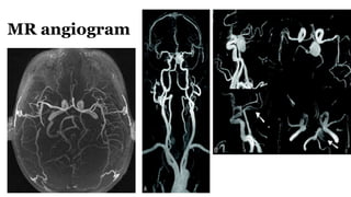 MR angiogram
 