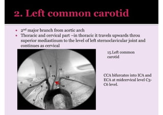 cerebral angio (2) editannnnnnnnnnnnble-3.pptx