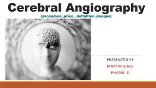 Cerebral Angiography(procedure ,price , definition ,images)
PRESENTED BY
MARTIN SHAJI
PHARM D
 