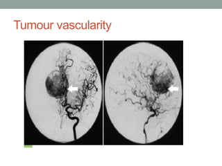 Tumour vascularity
 