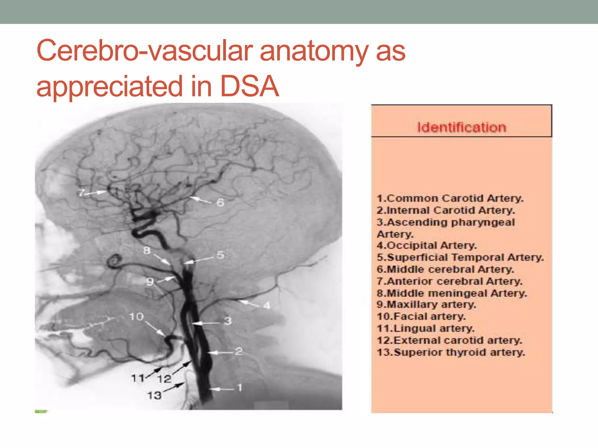 Cerebro-vascular anatomy as
appreciated in DSA
 