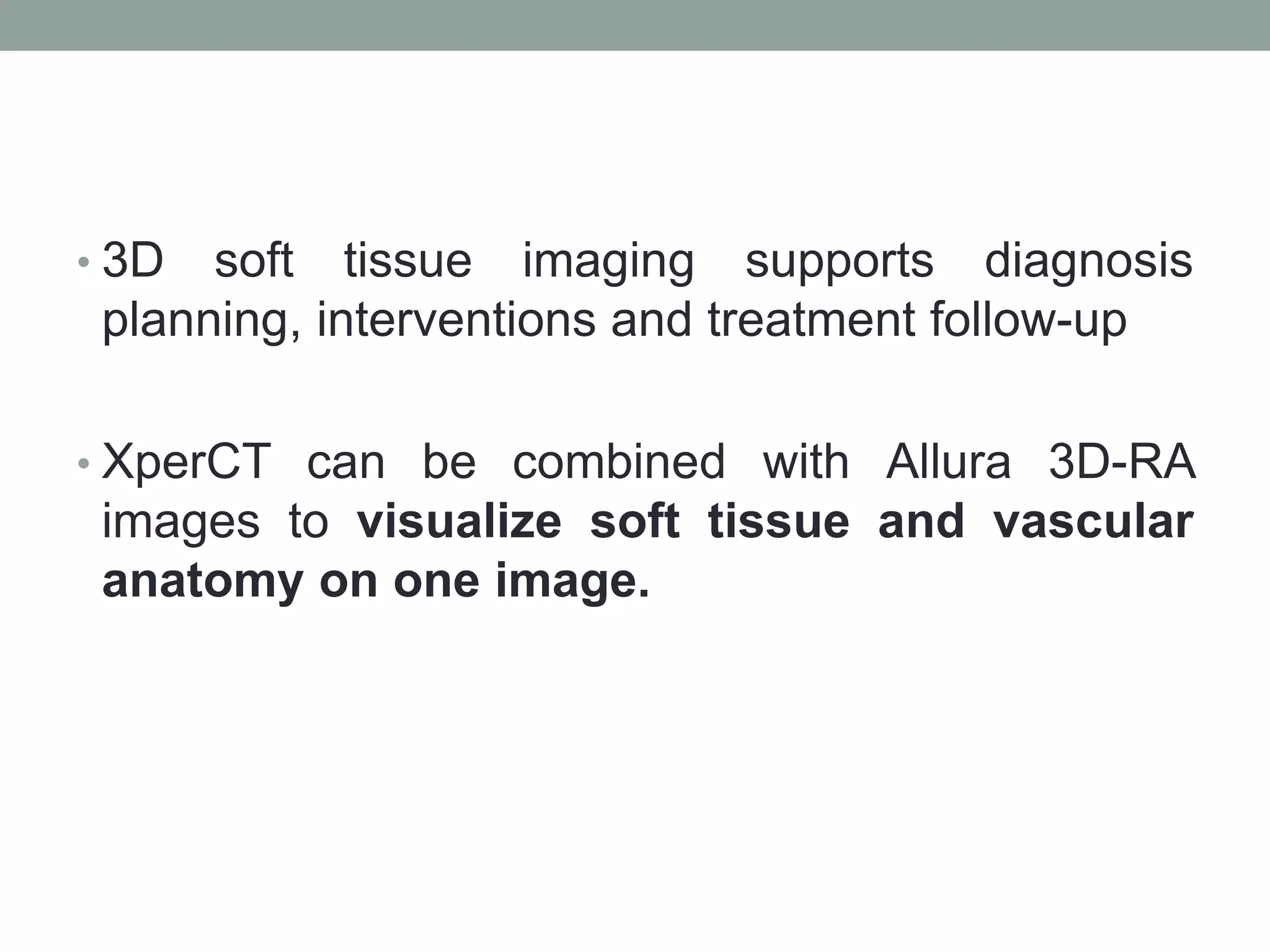 • 3D soft tissue imaging supports diagnosis
planning, interventions and treatment follow-up
• XperCT can be combined with Allura 3D-RA
images to visualize soft tissue and vascular
anatomy on one image.
 