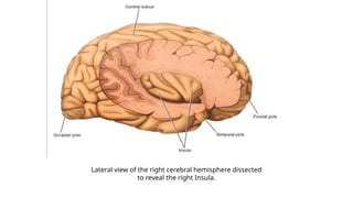 Lateral view of the right cerebral hemisphere dissected
to reveal the right Insula.
 