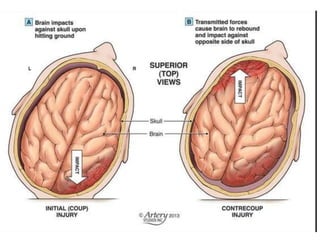Cerebral blood flow