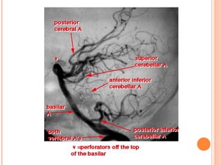 Cerebral circulation by DR.ARSHAD
