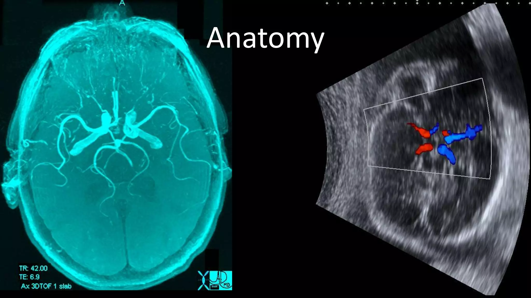 Cerebral circulation | PPTX