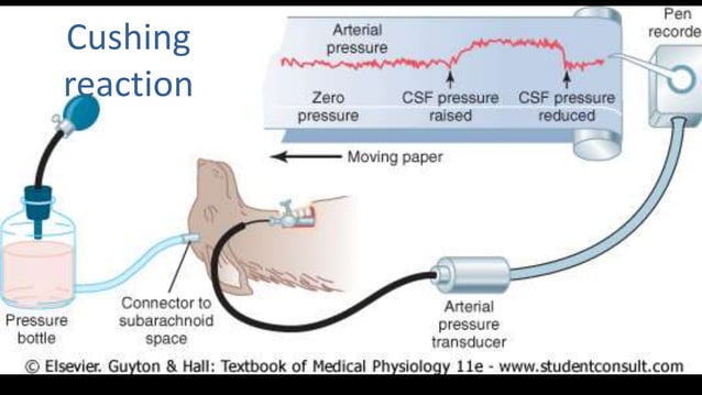 Cerebral circulation | PPTX