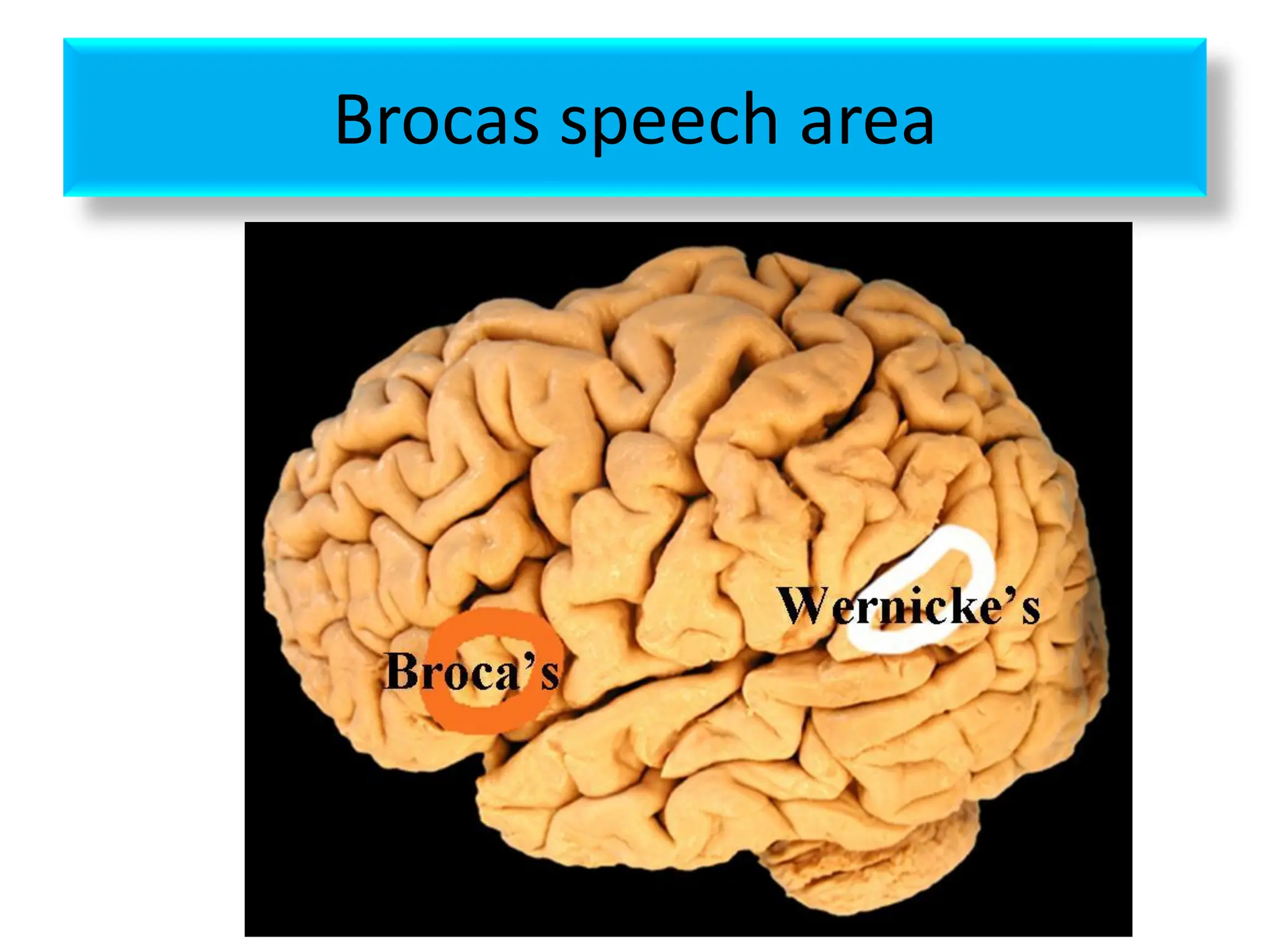 Brocas speech area
 