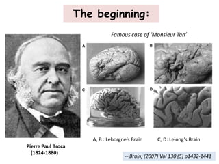 The beginning:
A, B : Leborgne’s Brain C, D: Lelong’s Brain
-- Brain; (2007) Vol 130 (5) p1432-1441
Pierre Paul Broca
(1824-1880)
Famous case of ‘Monsieur Tan’
 