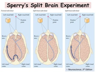 Sperry’s Split Brain Experiment
-- Neuroscience; 3rd Edition
 