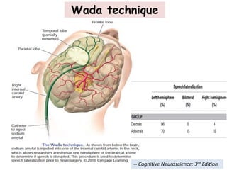 Wada technique
-- Cognitive Neuroscience; 3rd Edition
 