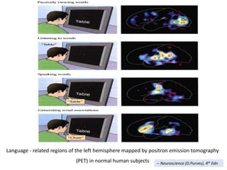 Language - related regions of the left hemisphere mapped by positron emission tomography
(PET) in normal human subjects -- Neuroscience (D.Purves), 4th Edn
 