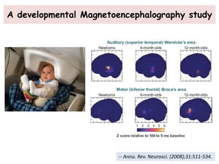 A developmental Magnetoencephalography study
-- Annu. Rev. Neurosci. (2008);31:511-534.
 