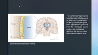 cerebral edema types management and description | PPTX