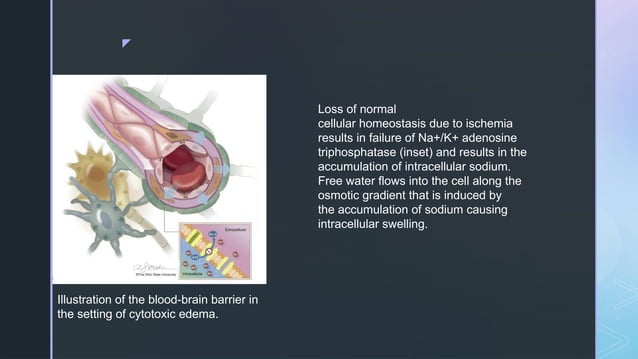 cerebral edema types management and description | PPTX