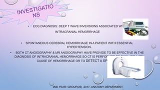 • ECG DIAGNOSIS: DEEP T WAVE INVERSIONS ASSOCIATED WITH
INTRACRANIAL HEMORRHAGE
• SPONTANEOUS CEREBRAL HEMORRHAGE IN A PATIENT WITH ESSENTIAL
HYPERTENSION.
• BOTH CT ANGIOGRAPHY & MR ANGIOGRAPHY HAVE PROVIDE TO BE EFFECTIVE IN THE
DIAGNOSIS OF INTRACRANIAL HEMORRHAGE SO CT IS PERFORMED TO EXCLUDE A 2RY
CAUSE OF HEMORRHAGE OR TO DETECT A SPOT SIGN.
2ND YEAR: GROUP(26) -2017- ANATOMY DEPARTMENT
 