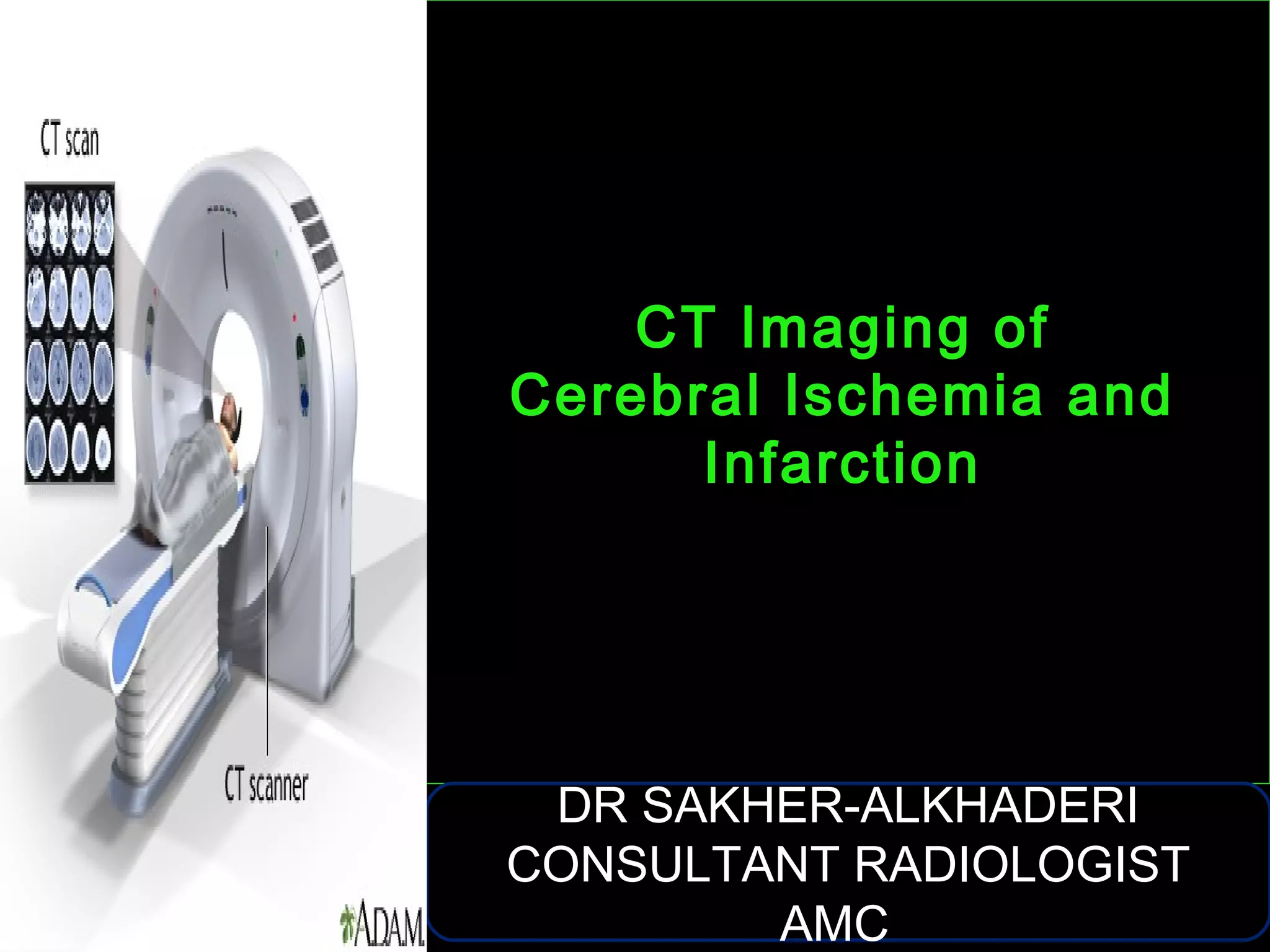 CT Imaging of Cerebral Ischemia and Infarction | PPT