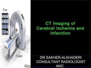 CT Imaging ofCT Imaging of
Cerebral Ischemia andCerebral Ischemia and
InfarctionInfarction
DR SAKHER-ALKHADERI
CONSULTANT RADIOLOGIST
AMC
 