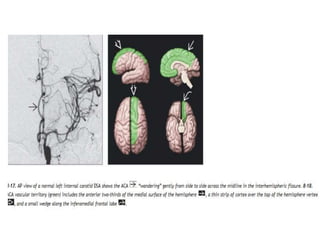 Imaging in cerebral ischemia | PPT