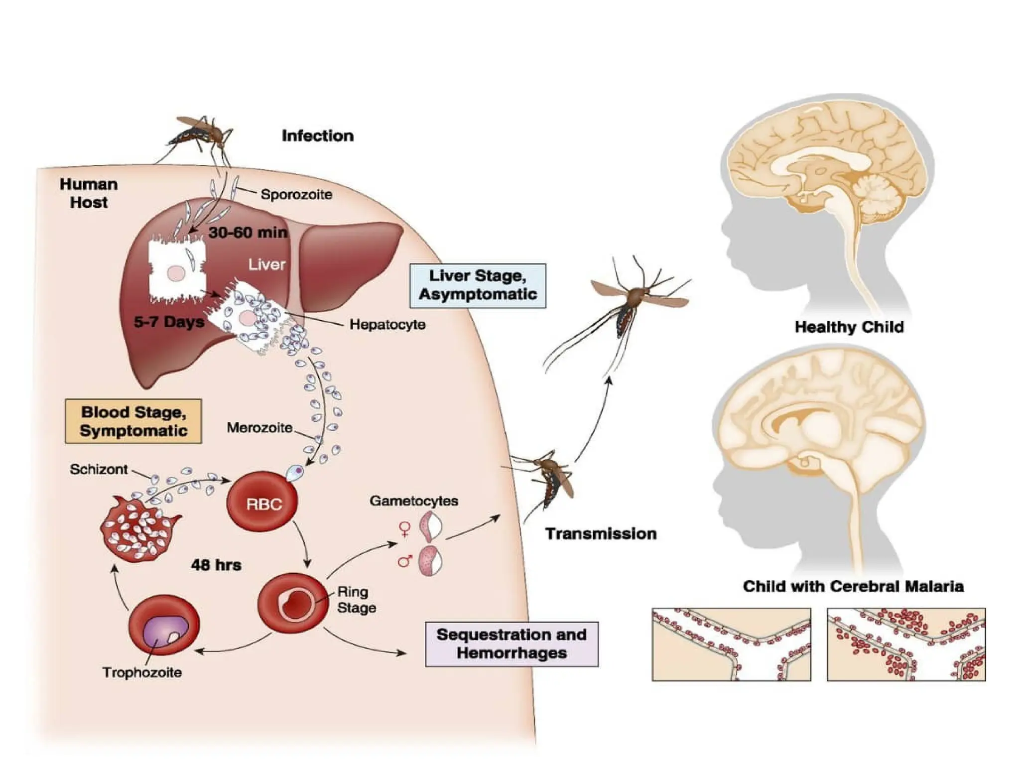 CEREBRAL MALARIA PRESENTATION and causes.pptx