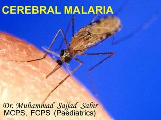 CEREBRAL MALARIA
Dr. Muhammad Sajjad Sabir
MCPS, FCPS (Paediatrics)
 