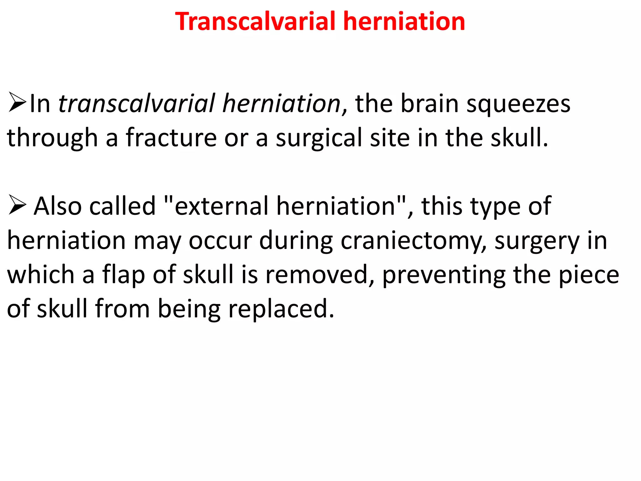 Transcalvarial herniation

In transcalvarial herniation, the brain squeezes
through a fracture or a surgical site in the skull.

 Also called "external herniation", this type of
herniation may occur during craniectomy, surgery in
which a flap of skull is removed, preventing the piece
of skull from being replaced.
 