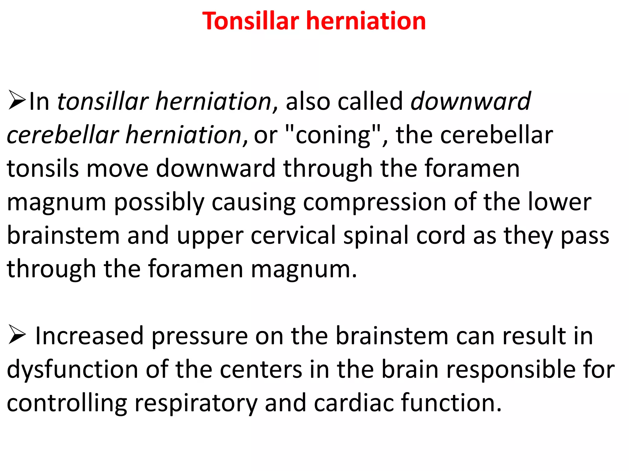 Tonsillar herniation

In tonsillar herniation, also called downward
cerebellar herniation, or "coning", the cerebellar
tonsils move downward through the foramen
magnum possibly causing compression of the lower
brainstem and upper cervical spinal cord as they pass
through the foramen magnum.

 Increased pressure on the brainstem can result in
dysfunction of the centers in the brain responsible for
controlling respiratory and cardiac function.
 